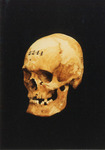 Photograph of Lewis Powell Skull